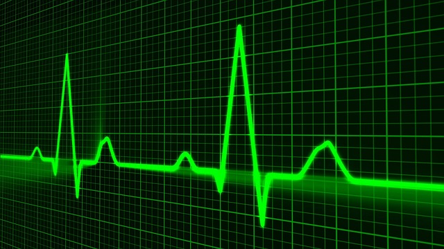 pulse-trace